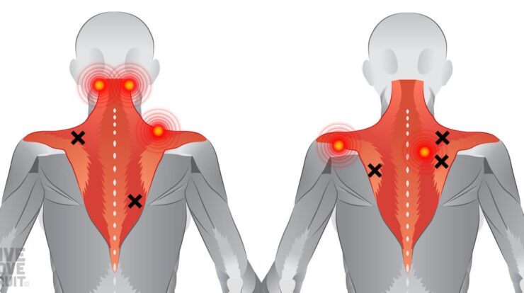 How can stiff and tight muscles result in back pain?